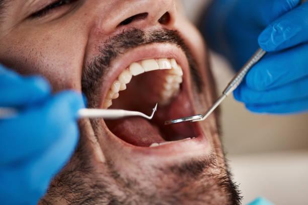 Best Broken or Chipped Tooth Repair in Cordova, AK